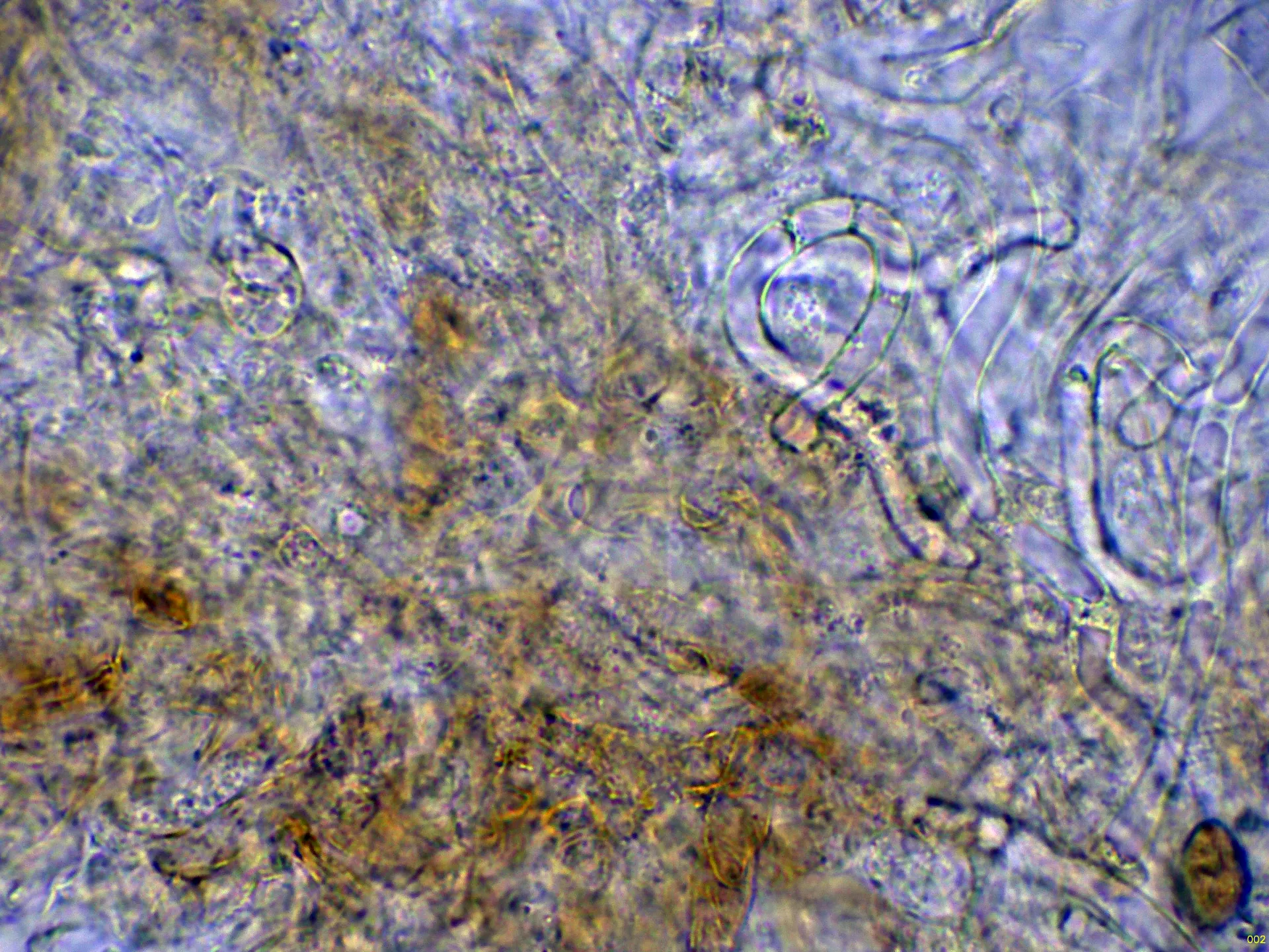 Microscopía de Phlegmacium inexspectatum - 5 - Suprapellis agua-002